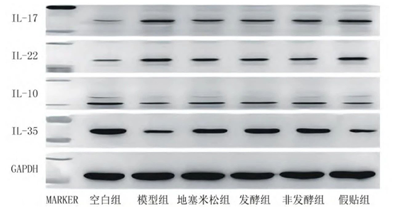 空白組和支氣管哮喘各組大鼠肺組織中IL－17、IL－22、IL－10、IL－35蛋白表達(dá)電泳圖